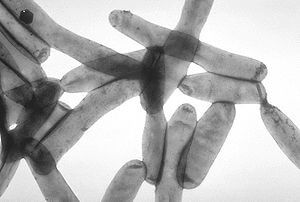 legionnaires disease claim compensation