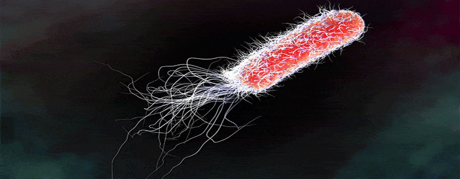 e coli bacteria caused death of a couple on holiday in Egypt